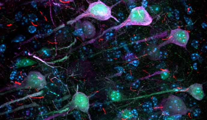 neuron and cilia under microscope