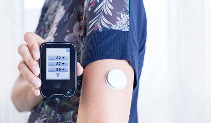 Glucose monitor
